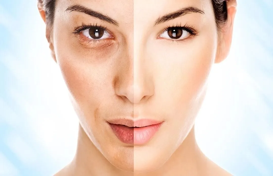 Uneven Skin Tone: The Perfect Way to correct it-Mediterranean Beauty